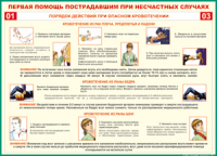 Таблица "Порядок действий при опасном кровотечении" (100х140 сантиметров, винил) - fgospostavki.ru - Владикавказ
