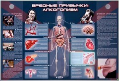 Электрифицированный стенд "Вредные привычки: алкоголизм" - fgospostavki.ru - Владикавказ