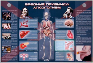 Электрифицированный стенд "Вредные привычки: алкоголизм" - fgospostavki.ru - Владикавказ